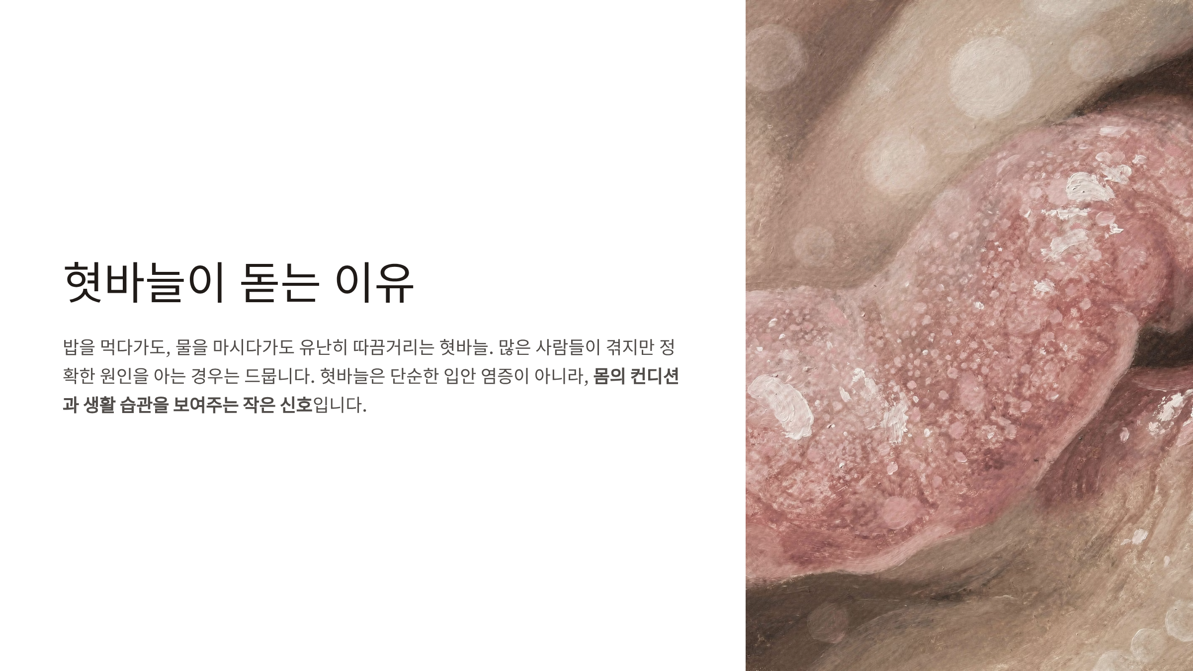 혓바늘이 돋는 이유