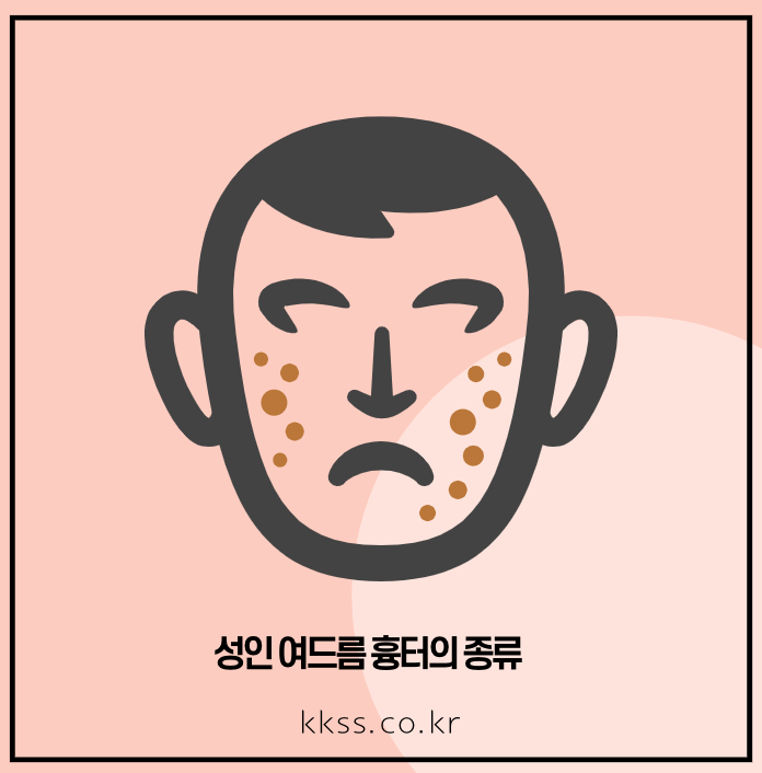 성인 여드름 흉터 없애는 법 3가지 종류 치료 방법 원인 실제 사례까지 - 성인 여드름 흉터의 종류 성인 여드름 흉터 없애는 법 3가지 종류 치료 방법 원인 실제 사례까지 - 성인 여드름 흉터의 종류