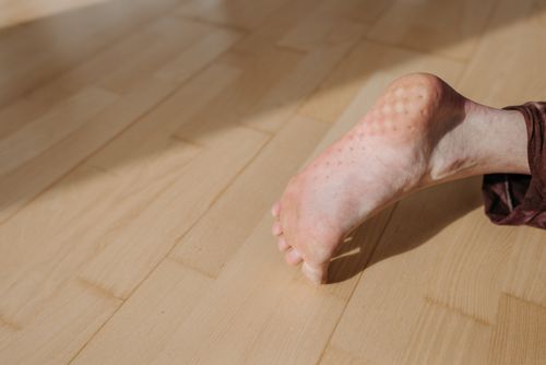 발에 땀 많아지는 이유 7가지&amp;#44; 단순 체질일까 발 다한증일까?