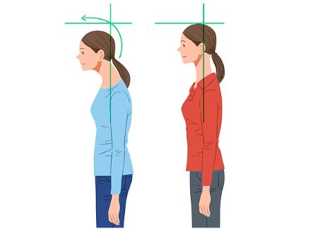 거북목 자세와 정상 자세 비교