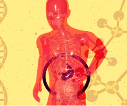 과민성 대장증후군 증상 예방 원인