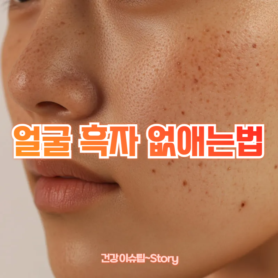 얼굴 흑자 없애는법