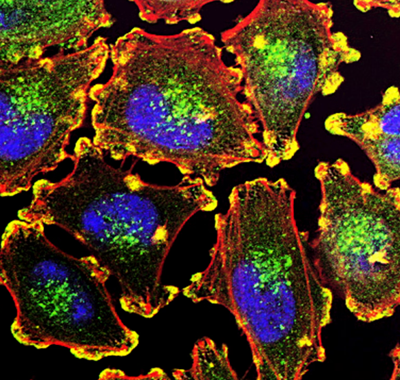 비오틴 효능 : 혈당