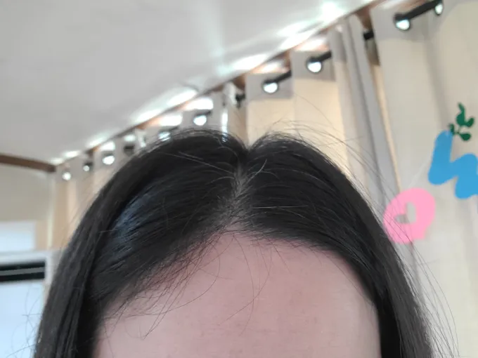 흰머리 새치 차이