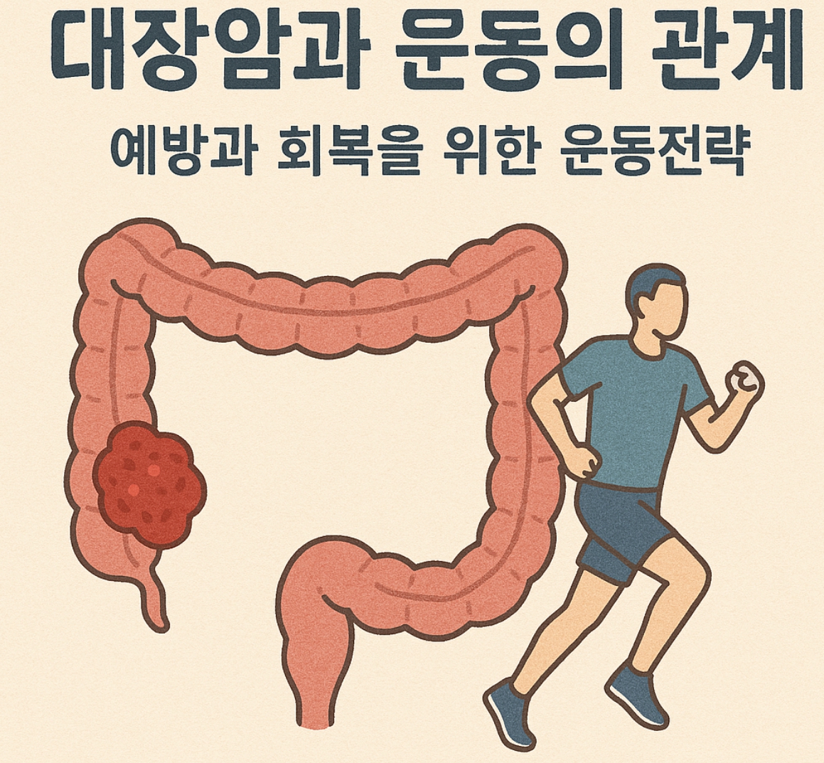 대장암과 운동과의 관계