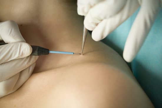 편평사마귀, 치료