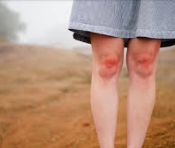 파상풍의 위험성