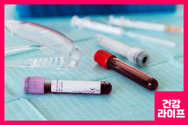 전립선암 psa수치 - 전립선암 자가진단