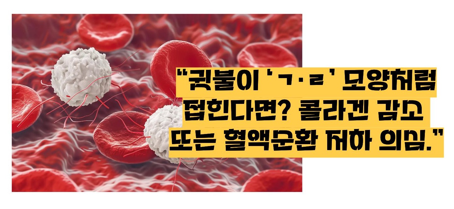 귓불에 주름의 신호