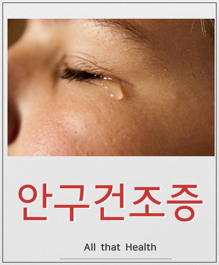 안구건조증 증상