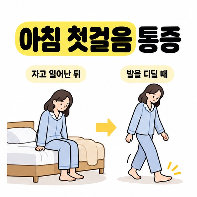 자고 일어난 뒤 침대에서 일어나 첫발을 디딜 때 나타나는 통증 상황을 연결한 이미지