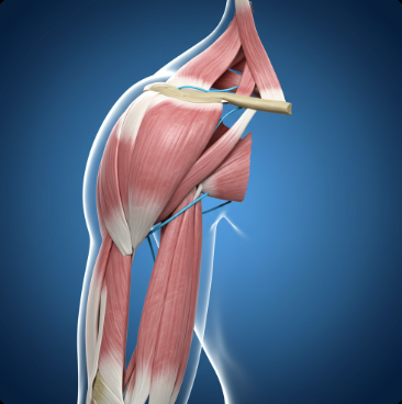 회전근개파열 증상 및 치료법1