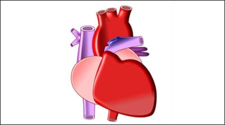 심혈관 모형 일러스트