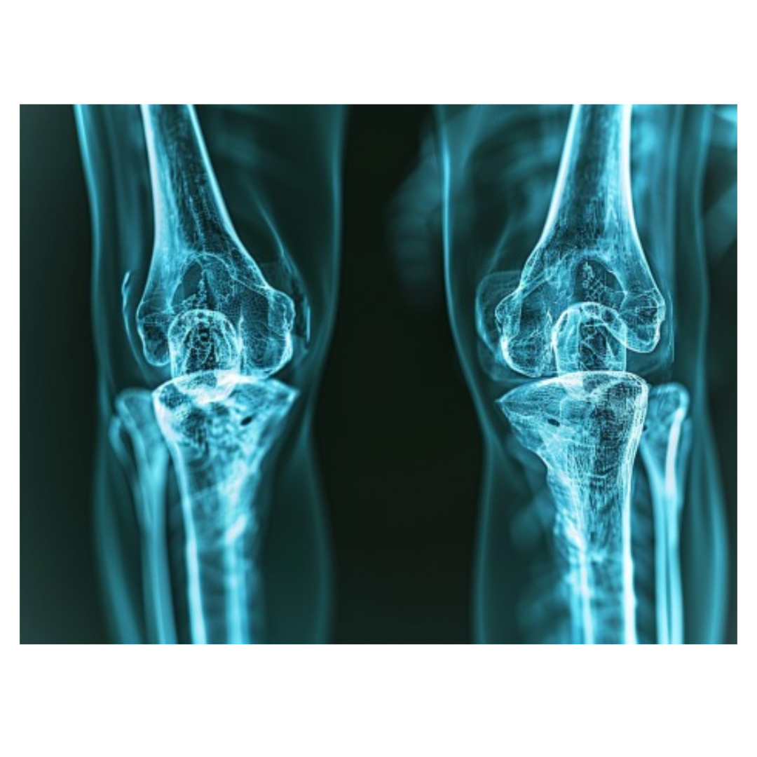 대장암과 관련된 사진입니다.