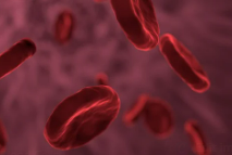 고칼슘혈증 이란? 원인 증상 진단방법 및 치료 방법 총정리!