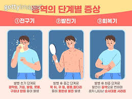 홍역이란 무엇일까