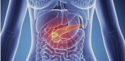 췌장-장기-구조