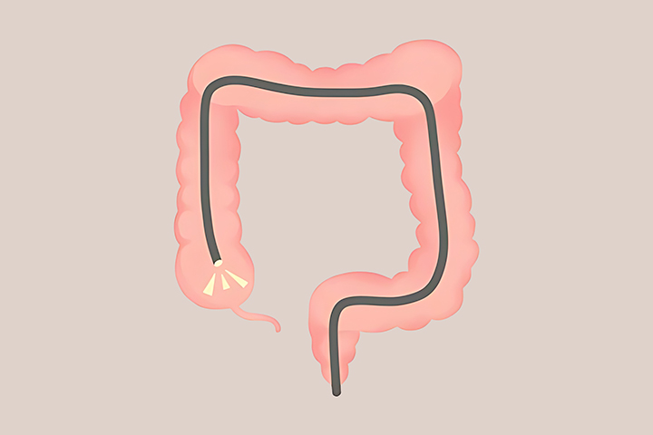 대장-내시경-검사