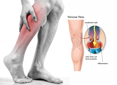 다리에 쥐가 자주 나는 이유 통증 해결하기 다리에 쥐 응급처치