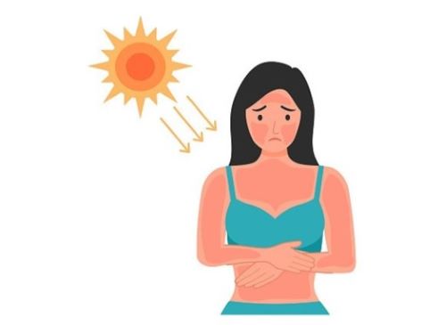 광피부염 일러스트 이미지