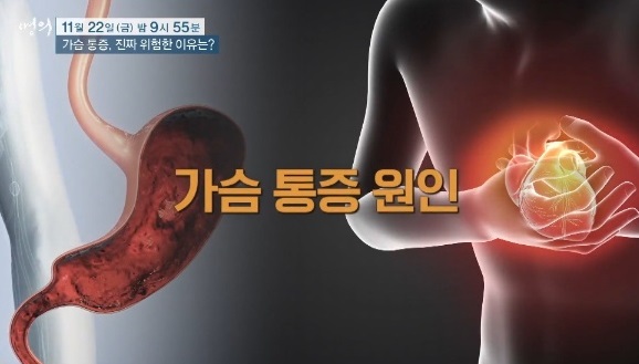 가슴통증원인