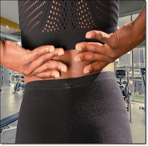 허리 통증 여성