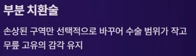 전방십자인대 보존형 무릎 부분치환술 - 부분치환술
