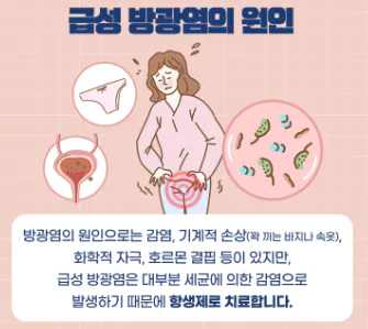 급성-방광염-원인