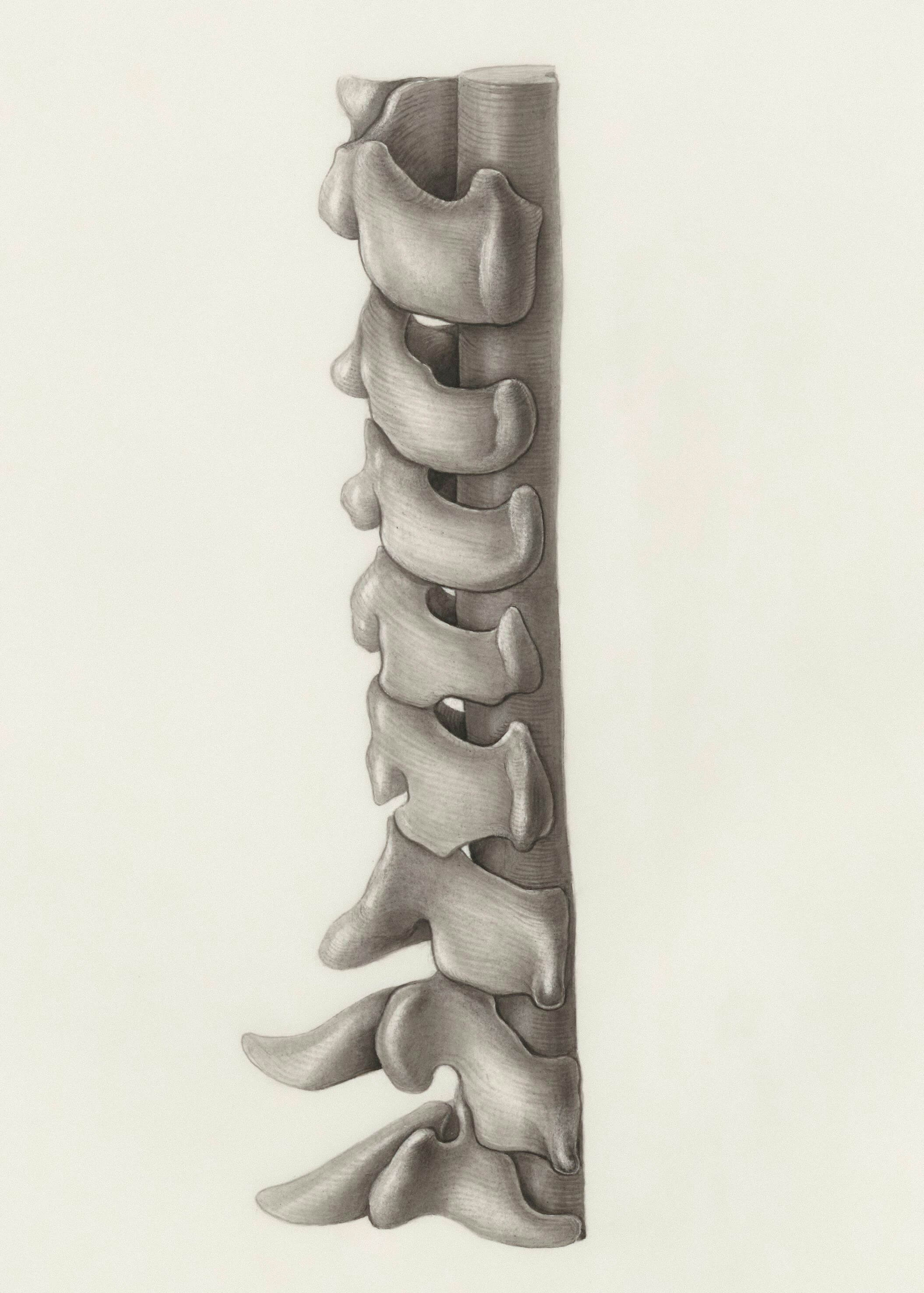허리디스크 다리저림