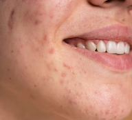 피부가려움증의 원인 12