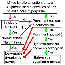 갑상선 기능 항진증