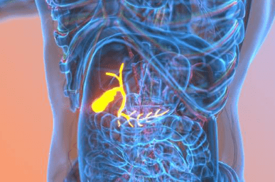 담낭염의 증상, 담낭 용종