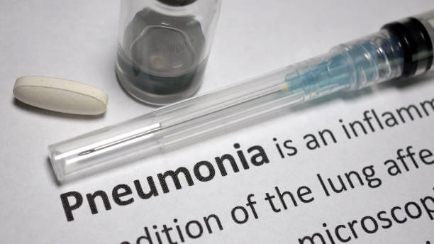 65세 이상 무료 지원! 폐렴 예방접종 최신 정보와 효과