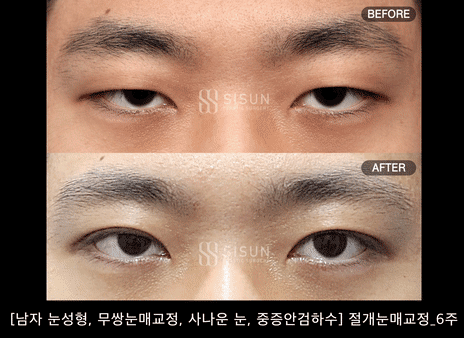 남자 쌍거플