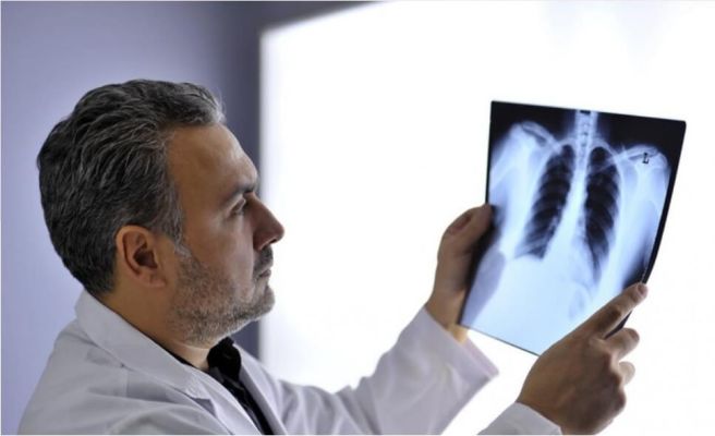 가슴이 답답하고 숨이 차는 증상