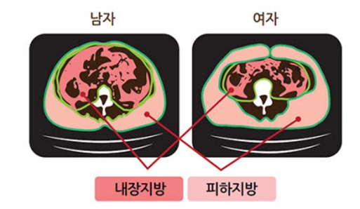 내장지방, 왜 위험할까?