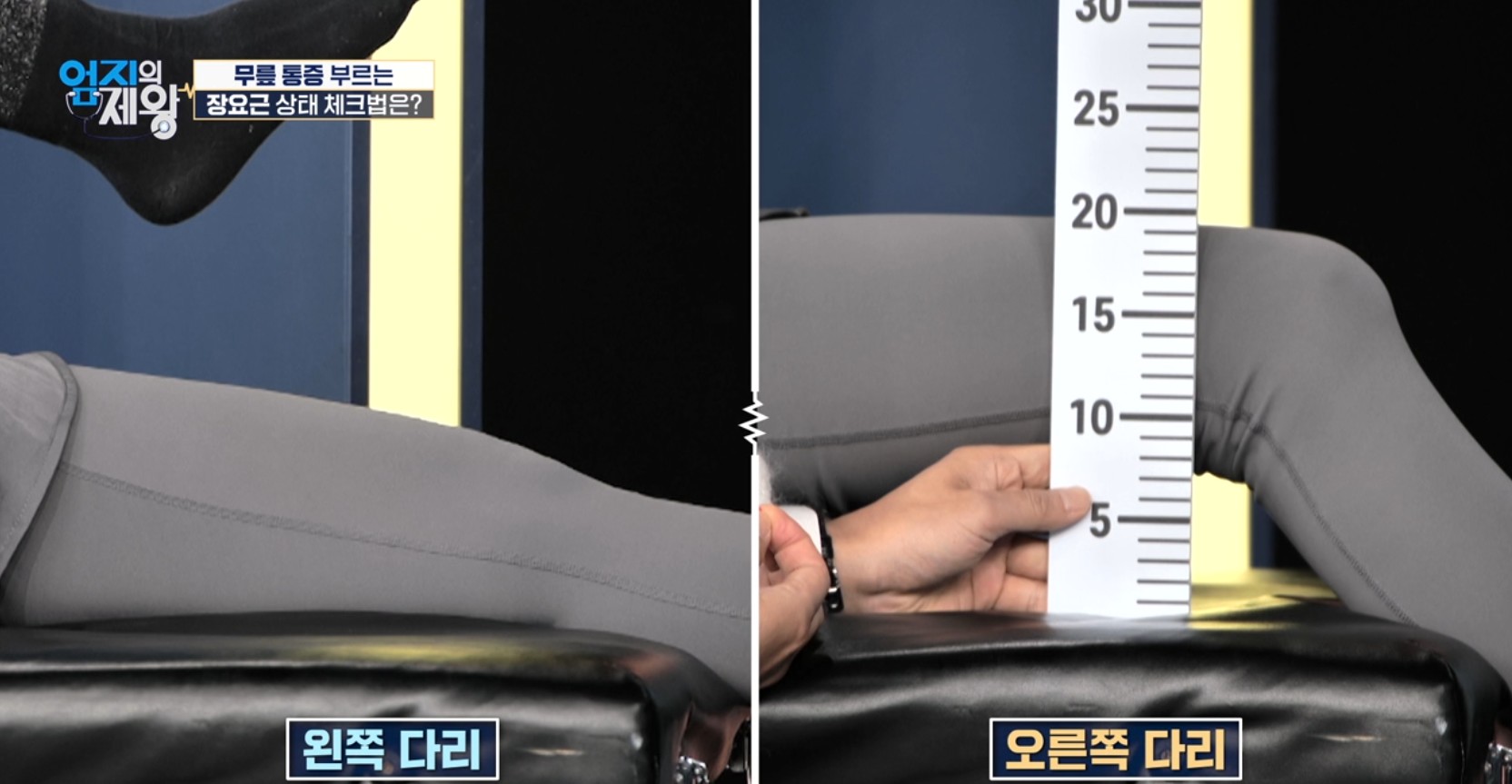 엄지의 제왕633화 무릎통증 배꼽옆 장요근 운동,연두부 레시피,난각막에 대하여