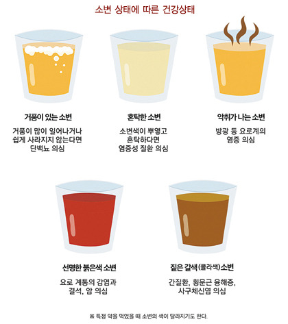 소변 상태에 따른 건강상태/ 출처- 백세시대