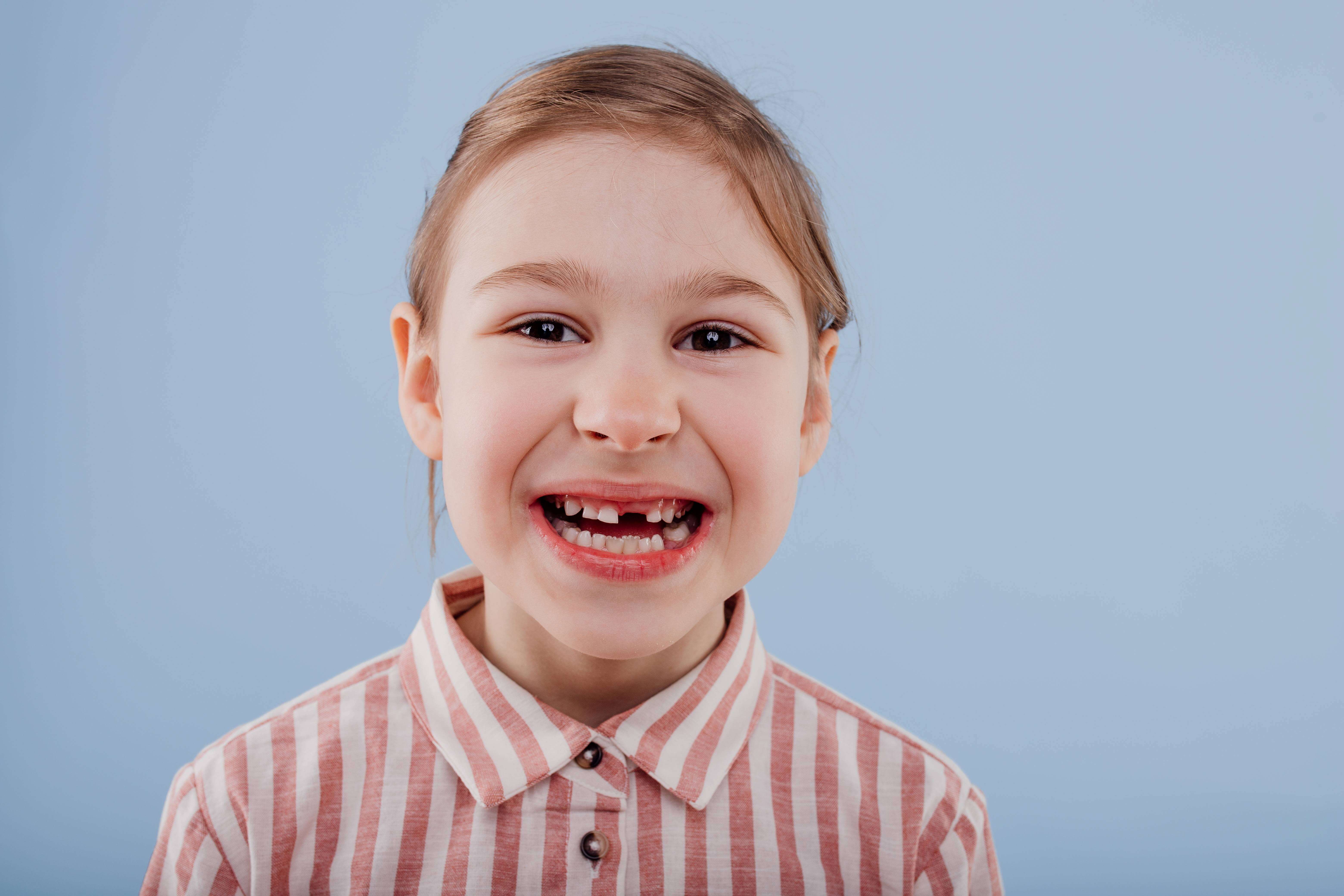 이가 빠진 어린이