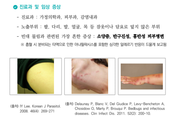 ktx 빈대