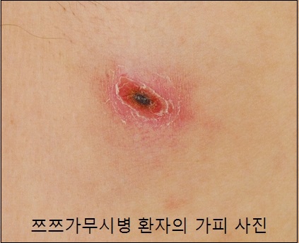 진드기-빈대-효과적인-퇴치제-기피제-살균기-스타일러스-비교구매가이드[가성비최고]