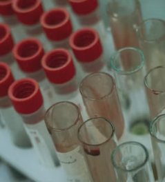 면역력이 떨어졌을 때 증상 저하 체크리스트