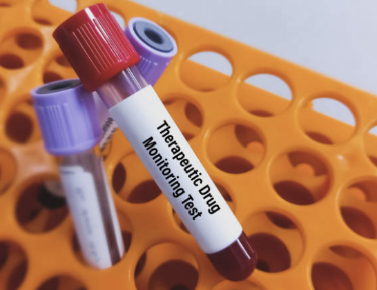 TDM sample 전처리 자동화로 Turnaround Time(TAT)을 줄이는 전략