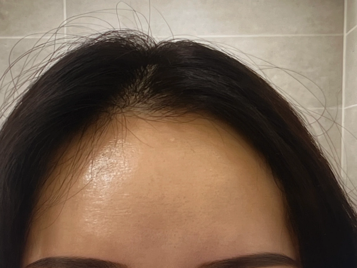 마이녹셀-프레스티지-스칼프-탈모-샴푸-후기-위해-찍은-내-모습