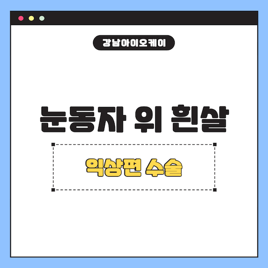 익상편-수술-눈동자-위-흰살