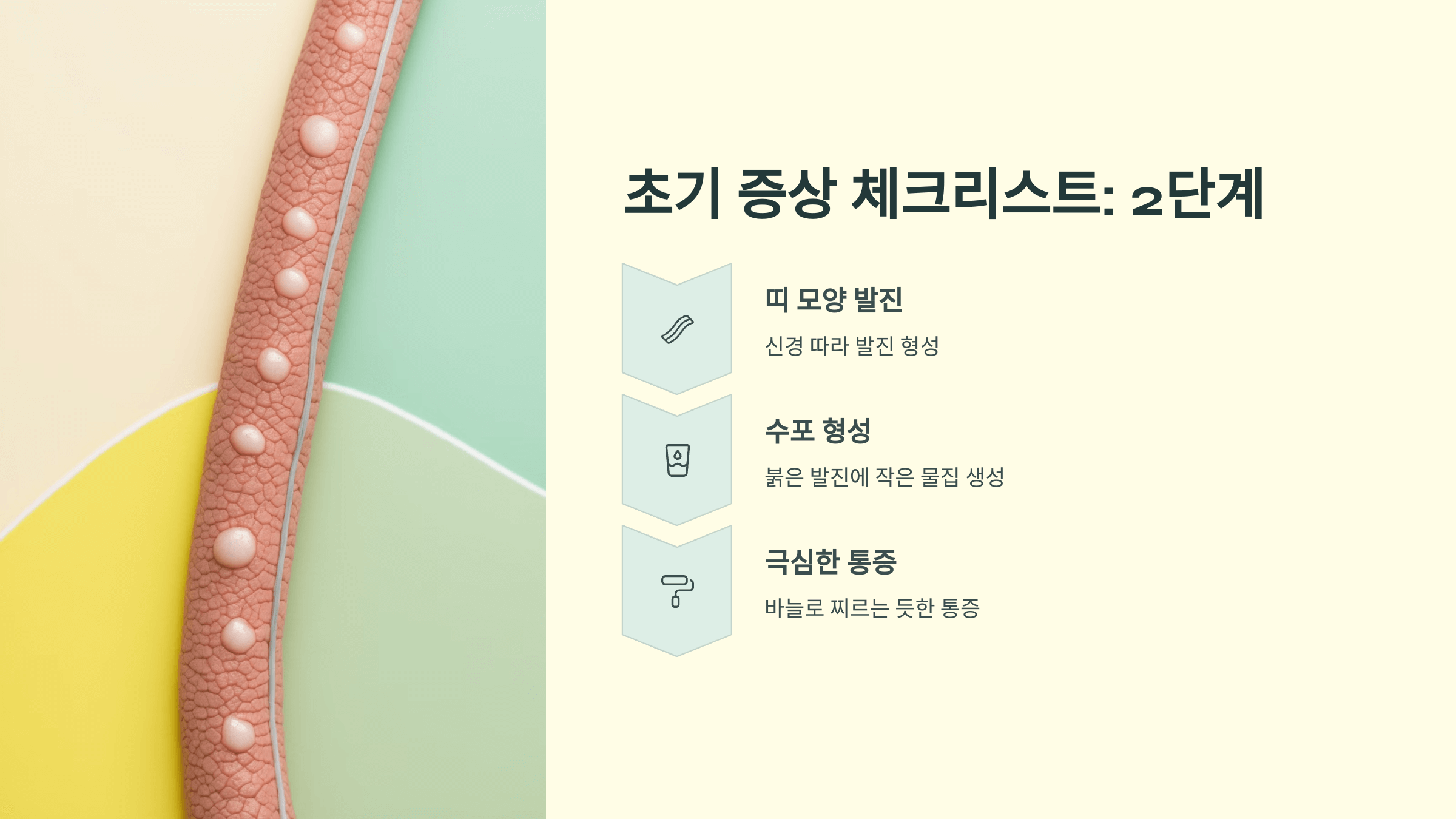 대상포진과 관련된 사진입니다.