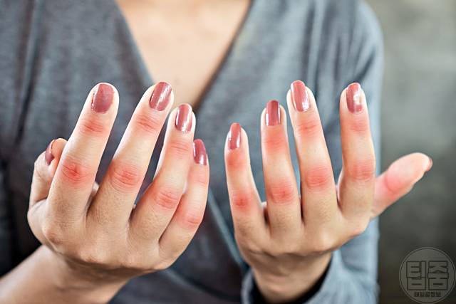 나트륨 과다섭취 증상 관절염 통증 나트륨하루권장량