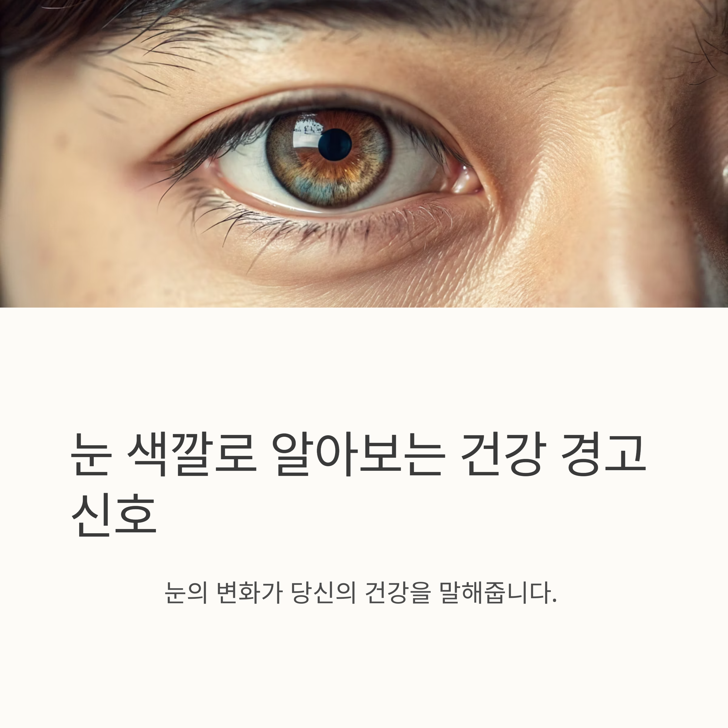 눈 색깔로 알아보는 건강 상태