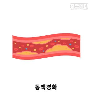 머리가 맑지 않는 증상 원인