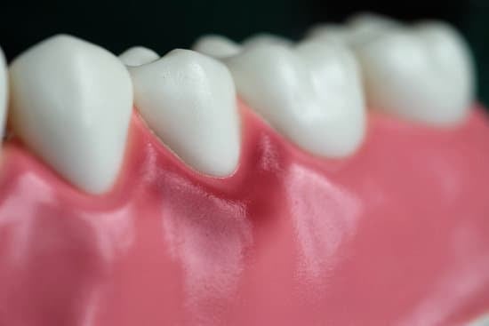 치은염(Gingivitis): 원인, 증상, 치료 및 예방